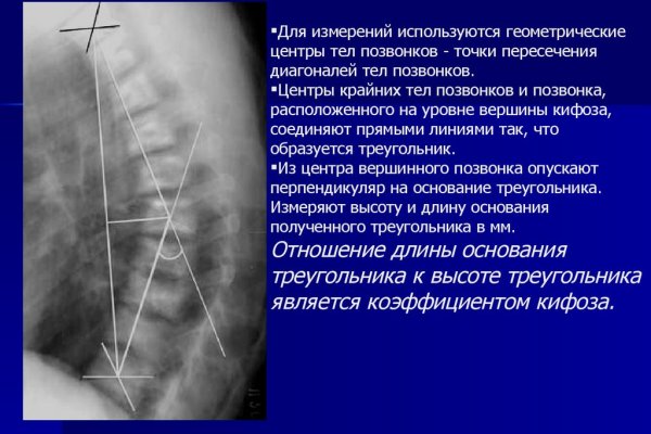 Картинка кракен маркетплейс